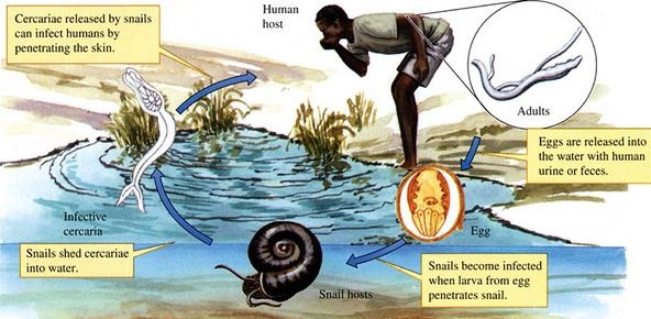 Schistosomiasis